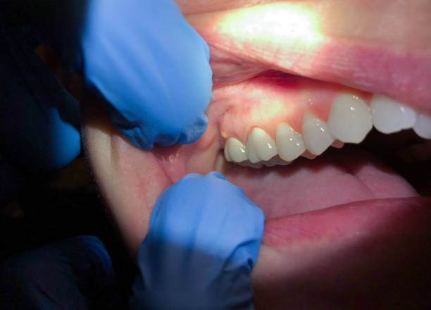 Best Weekend Emergency Dentist in Granbury, TX